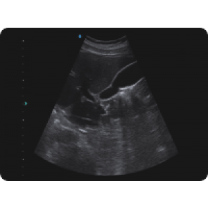 Ecograf Doppler color Apogee 5300