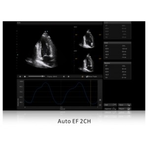 Ecograf Doppler color Apogee 5500
