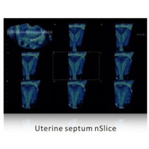 Ecograf Doppler color Apogee 5500