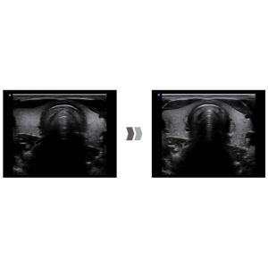 Ecograf Doppler color Apogee 5500