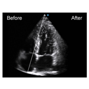 Ecograf Doppler color Apogee 5500
