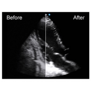 Ecograf Doppler color Apogee 5500