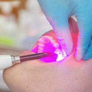 Laser dentar cu moduri duale de utilizare pentru chirurgie și terapie - LUMIX® SURGERY DUAL Dental