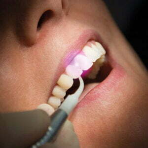 Laser dentar cu moduri duale de utilizare pentru chirurgie și terapie - LUMIX® SURGERY DUAL Dental