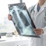 Boala pulmonară obstructivă cronică (BPOC)