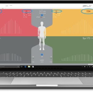Aparat măsurare indice glezna-brat Boso Abi-system 100