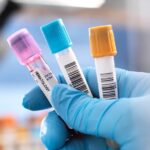 Cum să te pregătești pentru un test de colesterol?